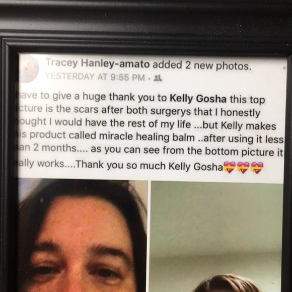 🛍️❤️🩹#CUREALL #ALLNATURAL 🛍MIRACLE HEALING BALM—BEST IN BEAUTY PICK - Picture 8 of 13